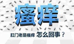 肛門(mén)瘙癢治不好嗎？先檢查病因就好辦！